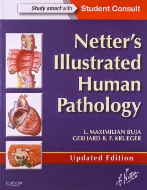 Netter's Illustrated Human Pathology Updated Edition